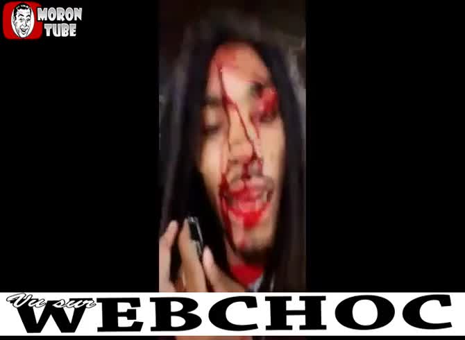 Video :After getting shot in the head, the rapper records a video of himself
